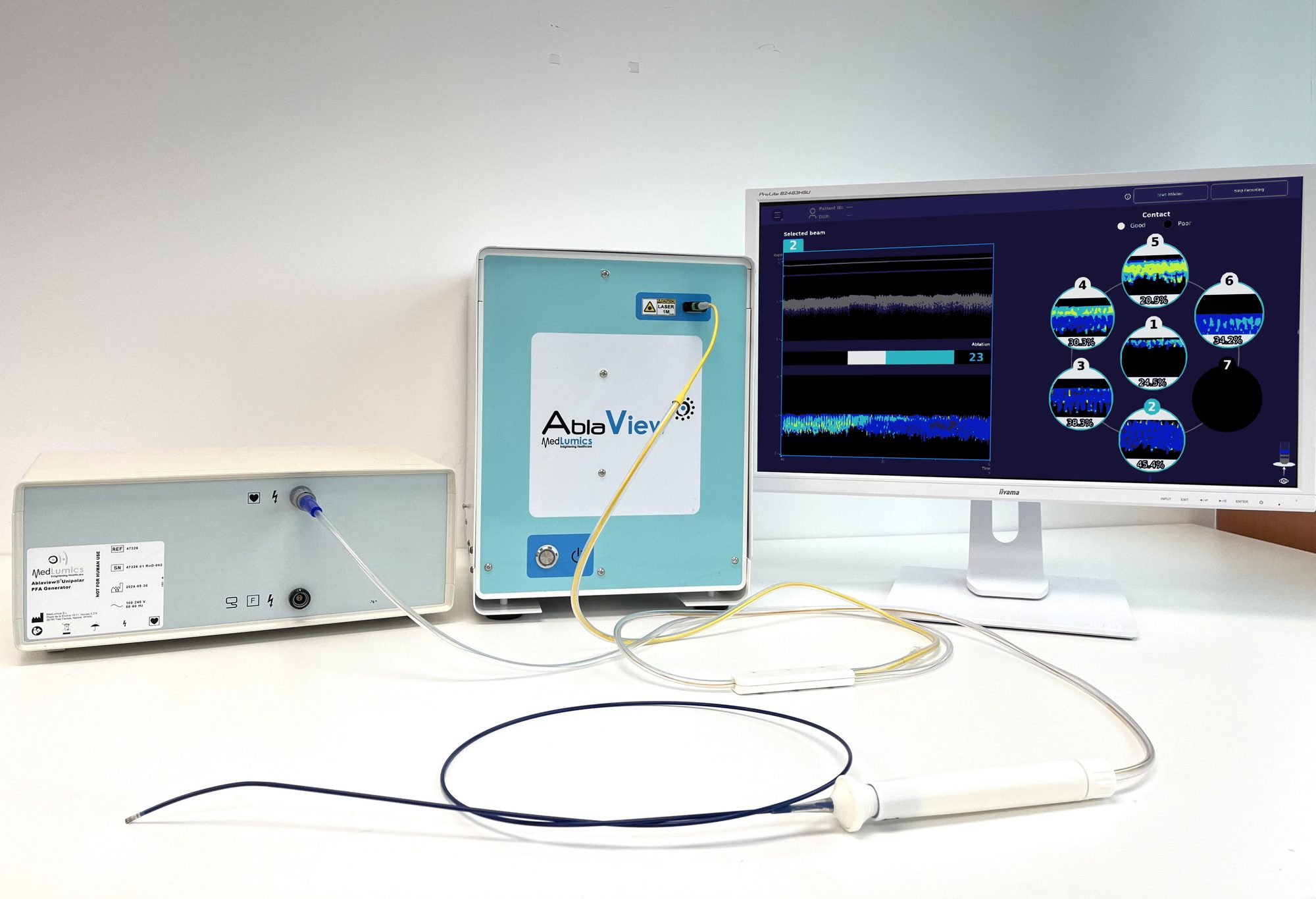 AblaView unipolar PFA system on a bench: PFA generator, AblaView console, live PS-OCR display with per-beam contact map, and the dual-energy catheter.